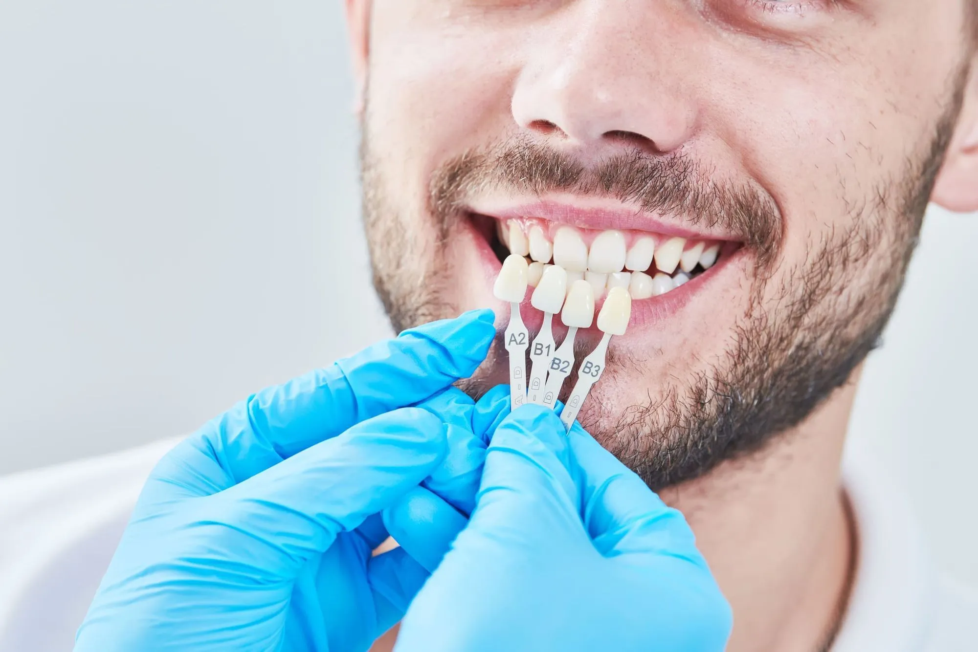 Dental Implant Restoration in Prairieville